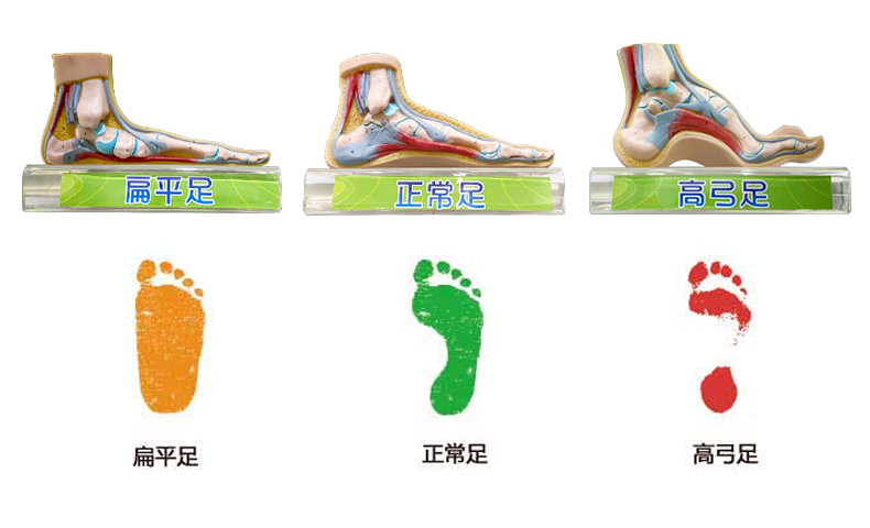 足弓測(cè)量精易迅